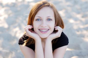 Young girl smiling with braces, Roseville NSW