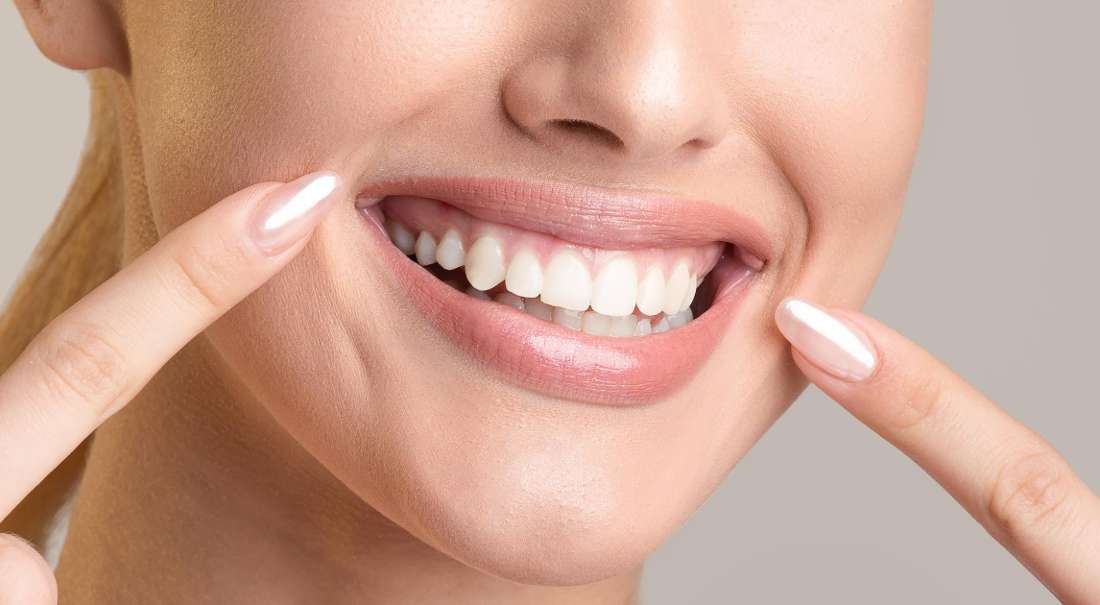 Why More Patients Choose Clear Aligners Clear Aligners Roseville Nsw