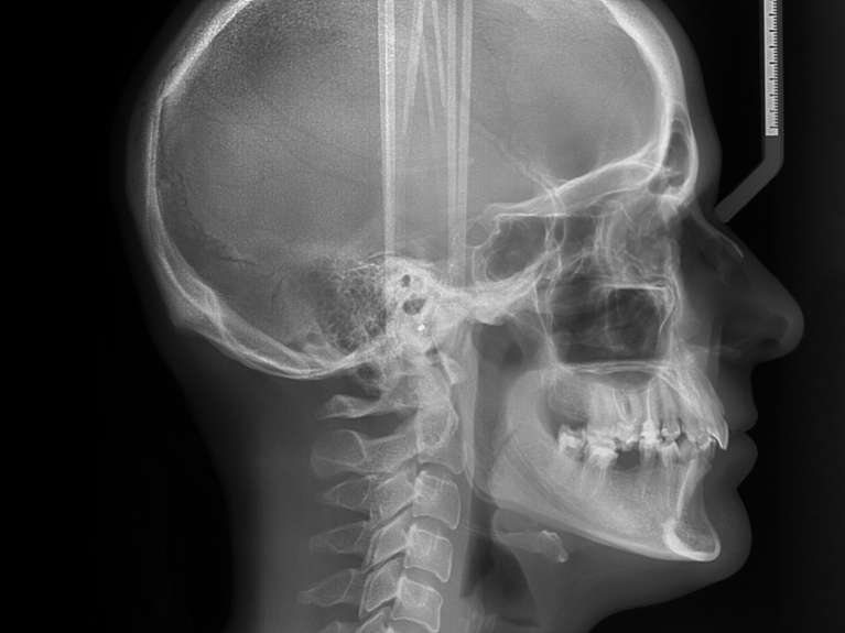 A cephalometric x-ray, Roseville NSW